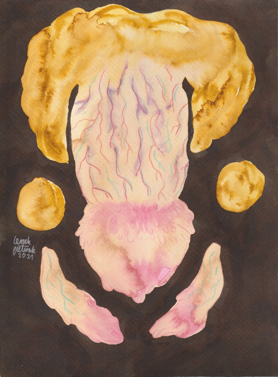 penis-with-pearly-penile-papules-5-2021-nsfw